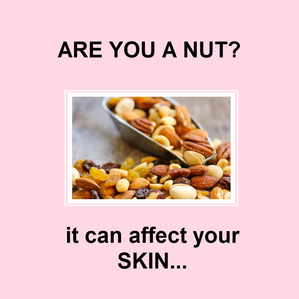 ARE YOU A NUT?